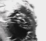 Stria Vascularis - Image 2